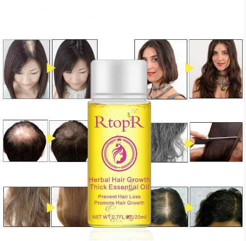Essential Oil Liquid Treatment Preventing Hair Loss Hair Care 20ml